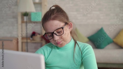portrait of a teenage girl with a defect or face burn using a laptop or computer