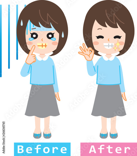 歯の黄ばみ　ホワイトニング