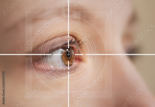 laser surgery concept close up of female eye with light flares photo