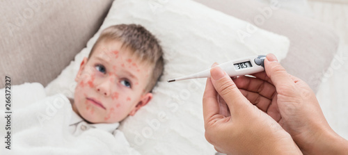 Quadro su tela High Fever Measles Virus. Mother Measuring Temperature Of Son