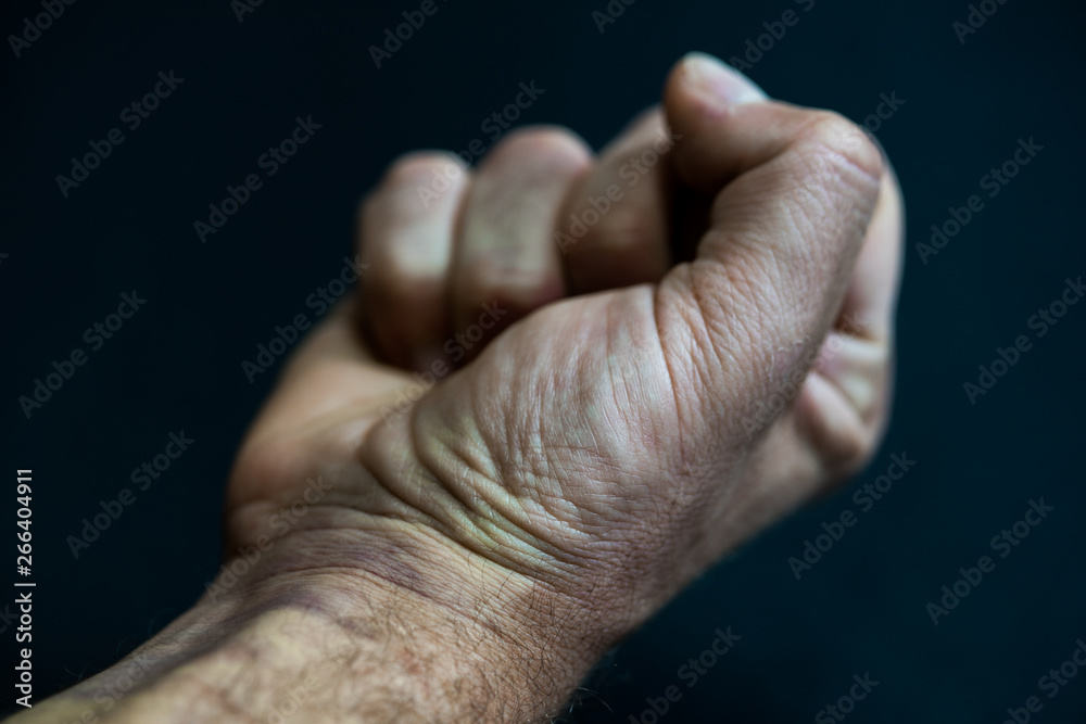 Fototapeta premium Fist closed on black background, arm with wounds in high contrast.