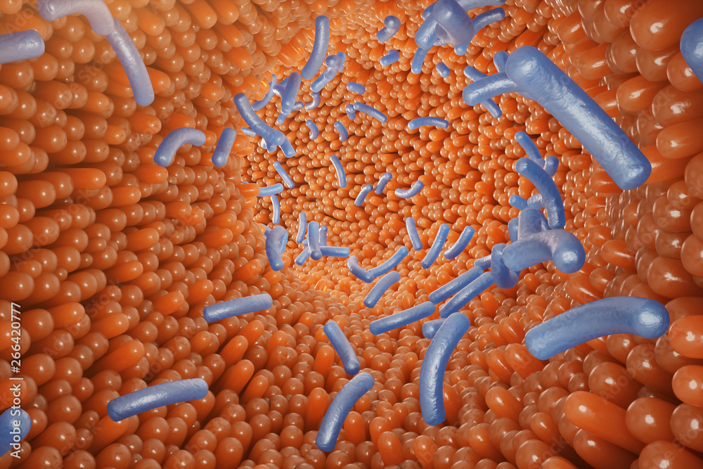 Infection In Intestines Intestinal villi, mucosa intestinal. Bacteria and microbes in ...
