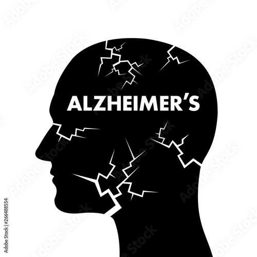 Alzheimer's disease - deterioration, degeneration, decay and decline of brain and mind in the head of man and human. Vector illustration