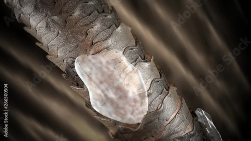 Human hair with dandruff, view to the microscope, 4K