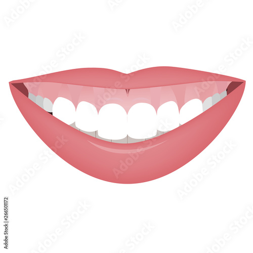 Mouth with a high smile line or gummy smile before the cosmetic, orthotropics or orthotropics correction. Vector illustration