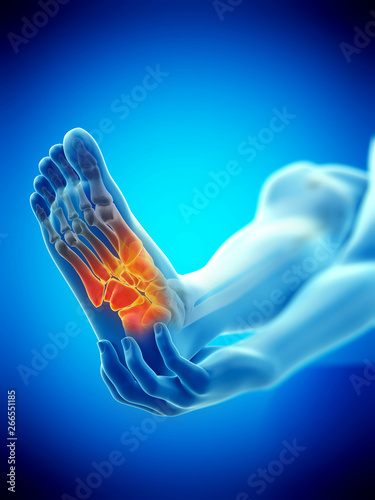 Slika na platnu 3d rendered medically accurate illustration of a painful ankle
