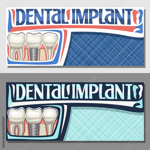 Vector banners for Dental Implant with copy space, layouts with 3 cartoon human teeth in jaw, invitation with lettering dental implant, sign board for professional denture clinic on blue background.