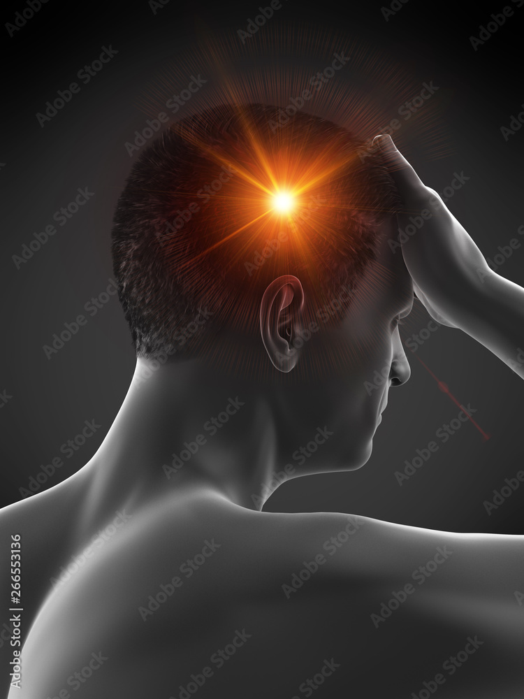 Fototapeta premium 3d rendered medically accurate illustration of a man having a migraine