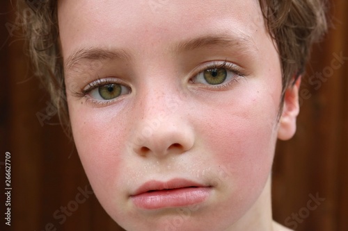 Macro shot of a child's hot face with flushed cheeks and sweat pearls above the lip