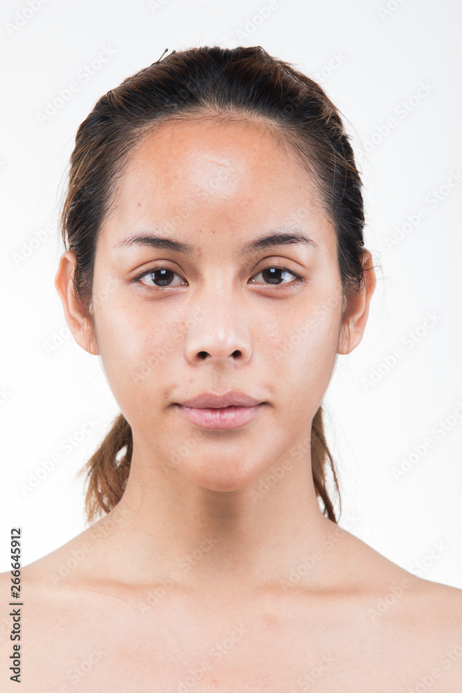 Asian Woman before applying make up hair style. no retouch, fresh face with acne, lips, eyes, cheek, nice smooth skin. Studio lighting white background, for aesthetics therapy treatment Asian Woman before applying make up hair style. no retouch, fresh face with acne, lips, eyes, cheek, nice smooth skin. Studio lighting white background, for aesthetics therapy treatment