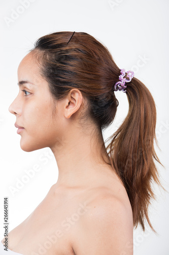 Asian Woman before applying make up hair style. no retouch, fresh face with acne, eyes, cheek, nice smooth skin. Studio lighting white background, aesthetics therapy treatment, rear side back view