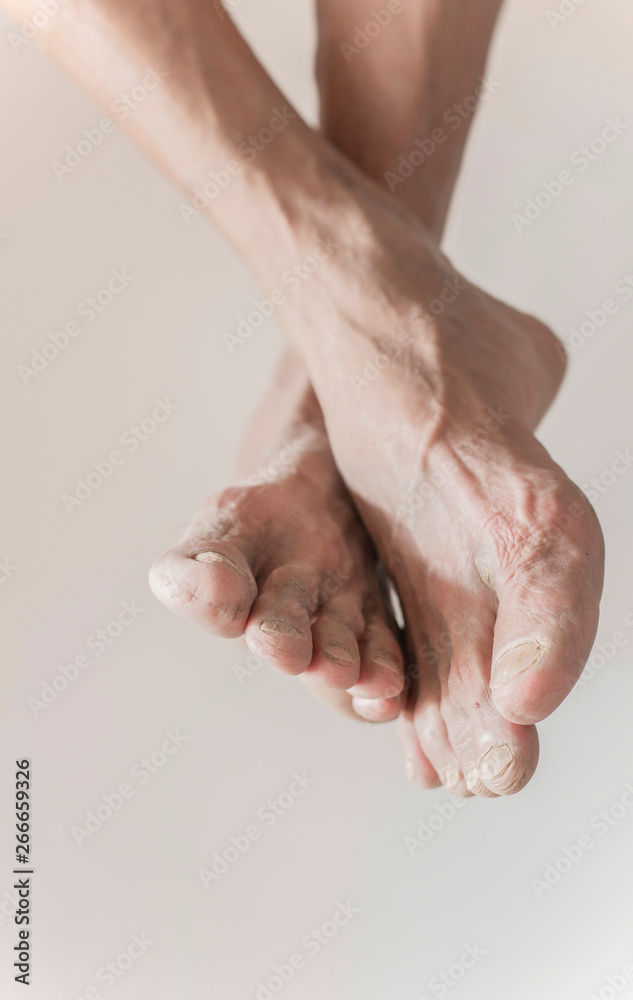 Fototapeta premium Both feet that are rough and degraded according to the physical
