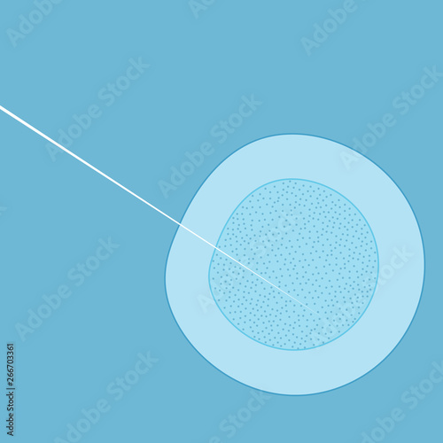 Medical operation, syringe thin needle or laser in cell invitro injection. Medicine biology, cell genetics and innovation healthcare technology, nuclear microbiology and cancer treatment