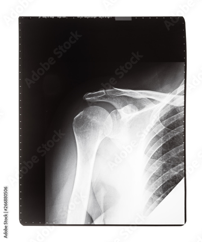 X-ray image of human shoulder joint photo
