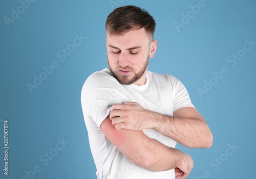 Man scratching arm on color background. Allergy symptoms photo