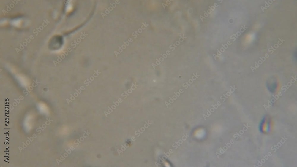 Sperm (spermatozoa) viewed under the microscope. Moving human sperm under Phase contrast Microscope. Close up showing spermatozoons. Video semen under microscope. 4K UHD Sperm (spermatozoa) viewed under the microscope. Moving human sperm under Phase contrast Microscope. Close up showing spermatozoons. Video semen under microscope. 4K UHD