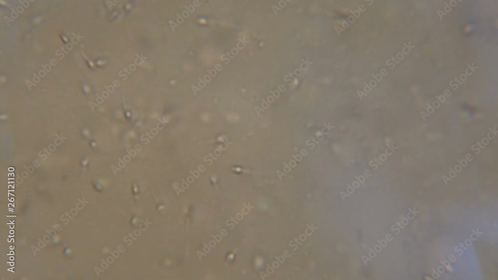 Sperm (spermatozoa) viewed under the microscope. Moving human sperm under Phase contrast Microscope. Close up showing spermatozoons. Video semen under microscope. 4K UHD Sperm (spermatozoa) viewed under the microscope. Moving human sperm under Phase contrast Microscope. Close up showing spermatozoons. Video semen under microscope. 4K UHD