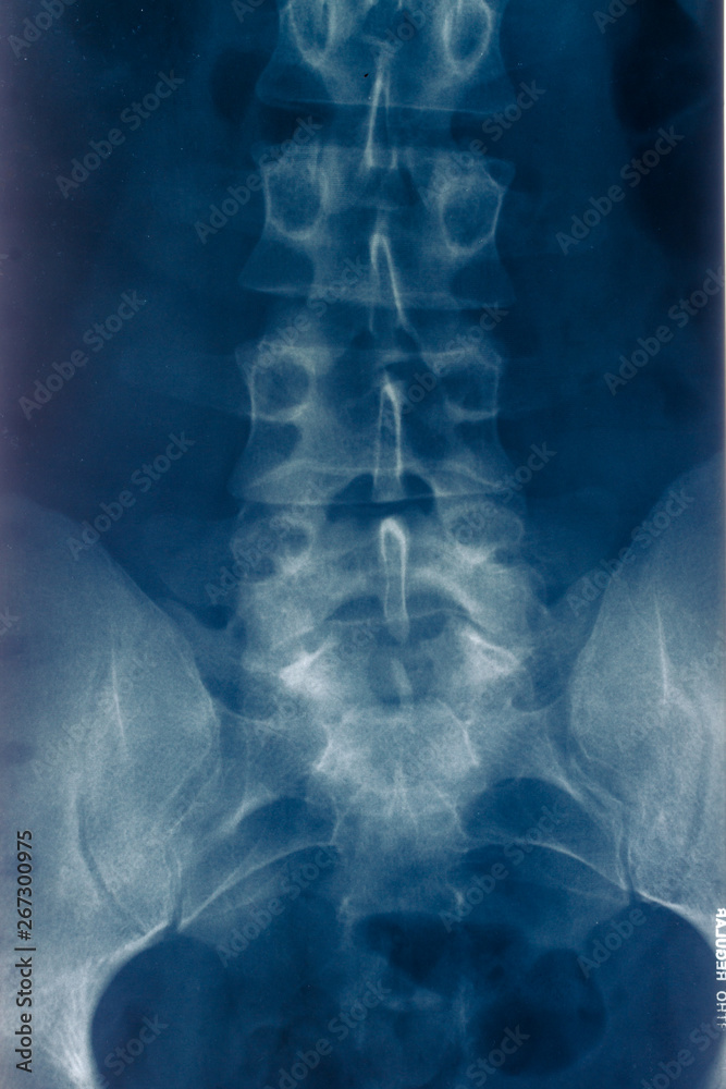 Fototapeta Spine RTG