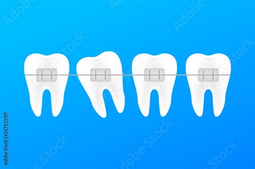Correction of teeth with orthodontic braces. Stages of teeth alignment. Dental clinic services. Vector stock illustration.