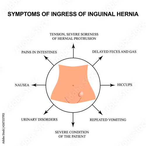 Symptoms of impaired inguinal hernia. Infographics. Vector illustration on isolated background.