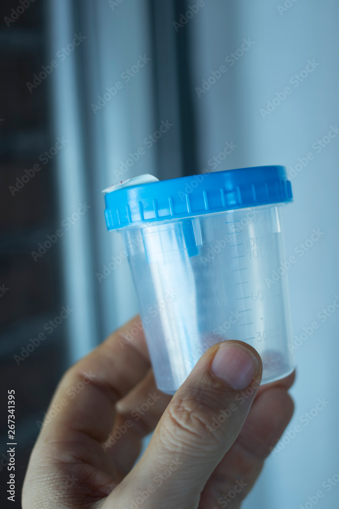 Urine sample test cup
