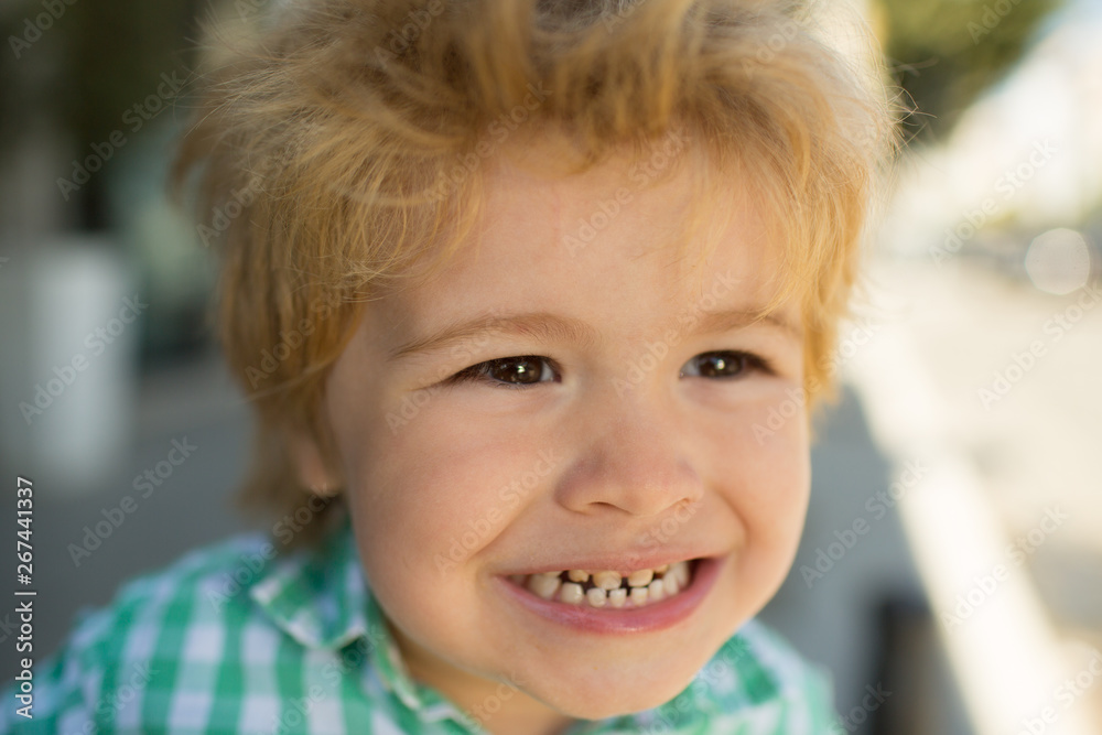 Milk teeth. Childrens dentist. The boy shows his teeth close-up. Baby smile. Portrait of a boy. Milk teeth. Childrens dentist. The boy shows his teeth close-up. Baby smile. Portrait of a boy.