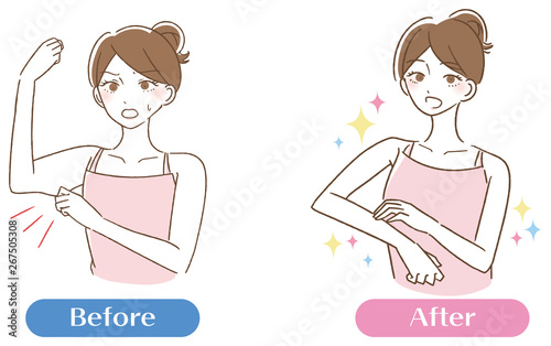 美容　二の腕　女性　イラスト