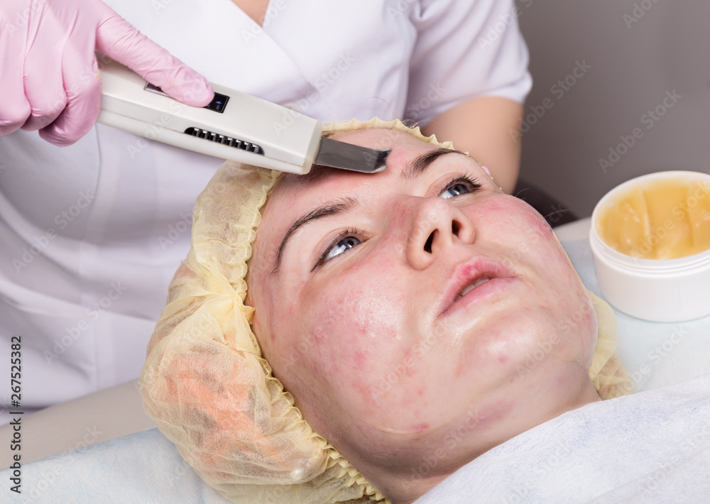 beautician at work. Ultrasonic face cleaning procedure for problem skin. Pore cleansing, oxygen saturation for woman's face beautician at work. Ultrasonic face cleaning procedure for problem skin. Pore cleansing, oxygen saturation for woman's face