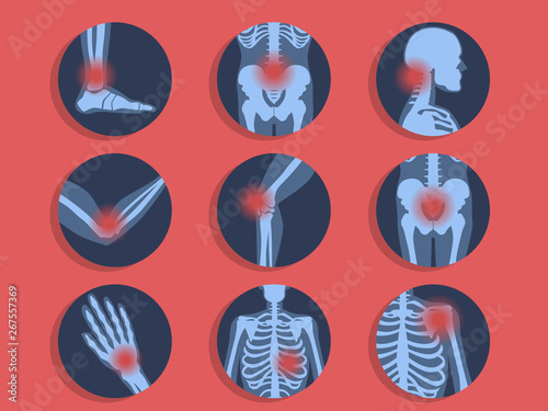 Different types of ache. Headache, abdominal pain