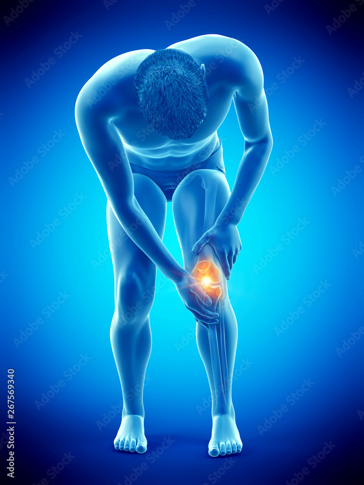 3d rendered medically accurate illustration of a painful knee 3d rendered medically accurate illustration of a painful knee