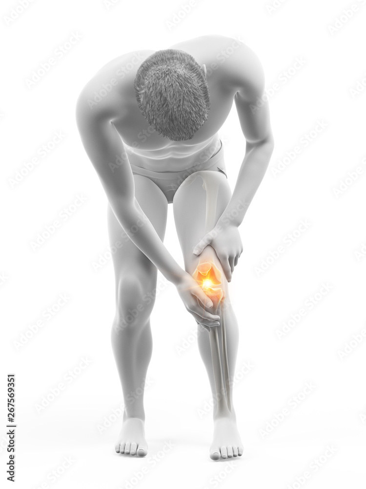 3d rendered medically accurate illustration of a painful knee
