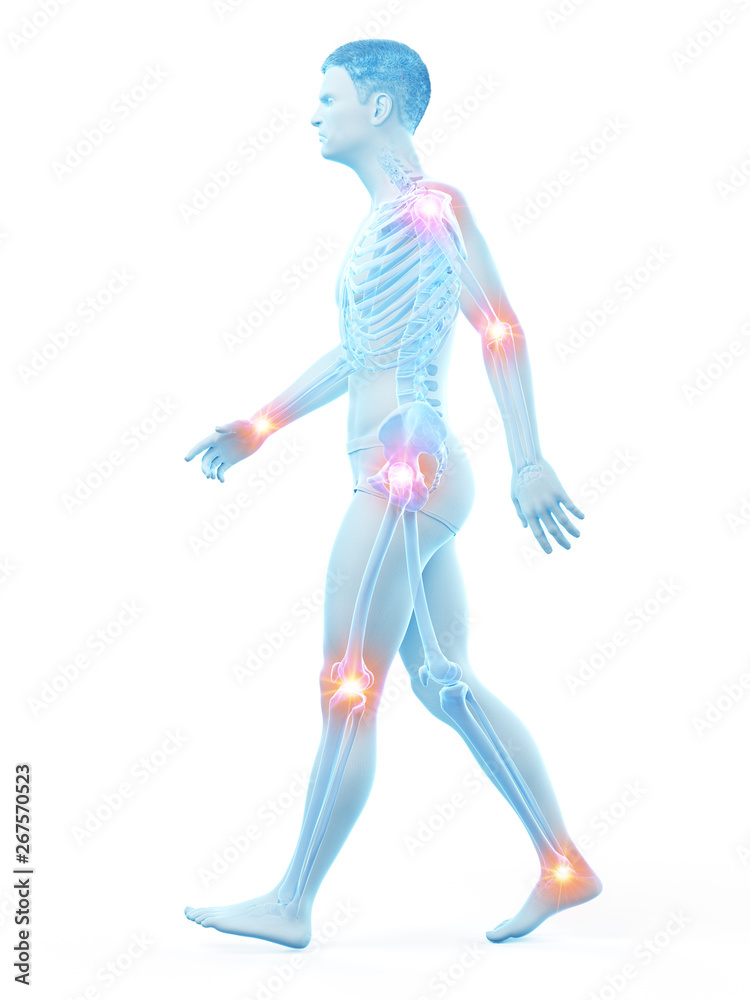 3d rendered medically accurate illustration of painful joints 3d rendered medically accurate illustration of painful joints