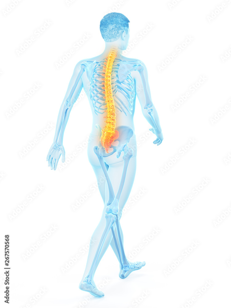 3d rendered medically accurate illustration of a walkers painful back 3d rendered medically accurate illustration of a walkers painful back
