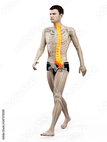 3d rendered medically accurate illustration of painful joints © Sebastian Kaulitzki