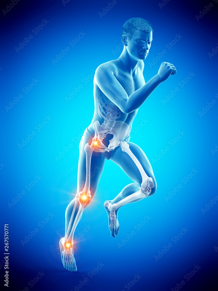 3d rendered medically accurate illustration of a runners painful joints 3d rendered medically accurate illustration of a runners painful joints