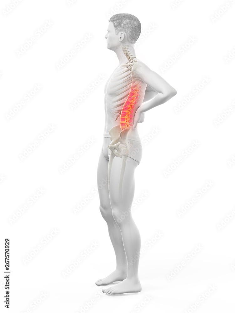 3d rendered medically accurate illustration of a mans painful back