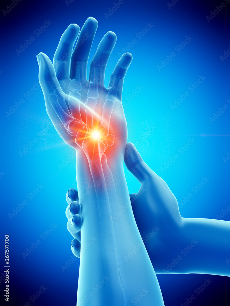 3d rendered medically accurate illustration of a man having a painful wrist