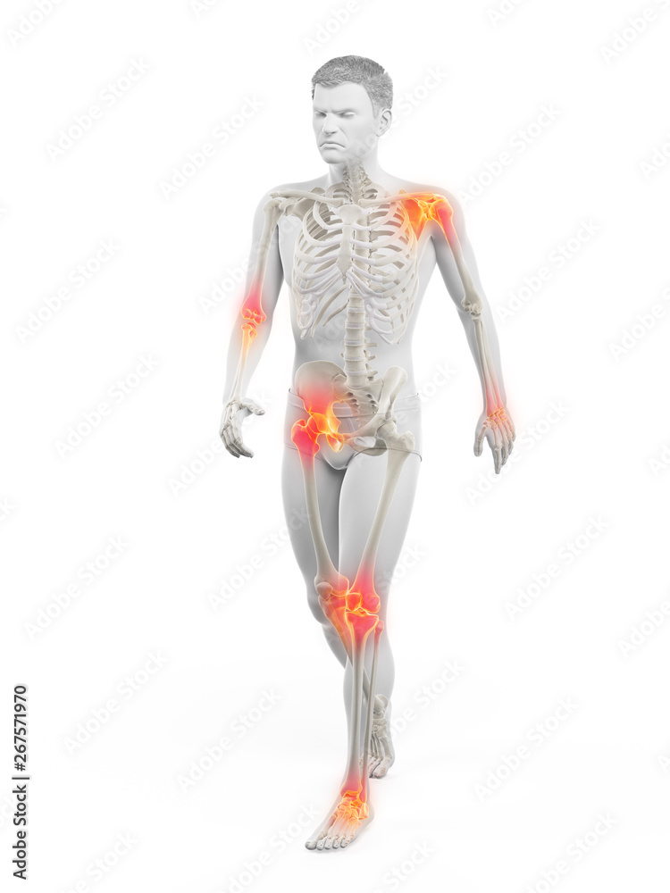 3d rendered medically accurate illustration of a walkers painful joints