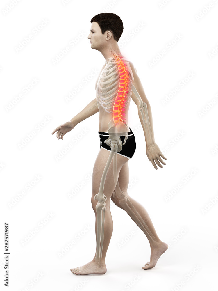 3d rendered medically accurate illustration of a painful back 3d rendered medically accurate illustration of a painful back