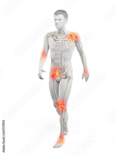 3d rendered medically accurate illustration of a walkers painful joints © Sebastian Kaulitzki