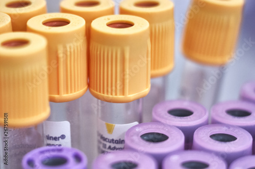 macro of test tubes with yellow top, against a gradient of white background. Selective focus