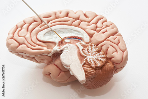 Concept of brain recording in subthalamic nucleus for Parkinson disease surgery. photo