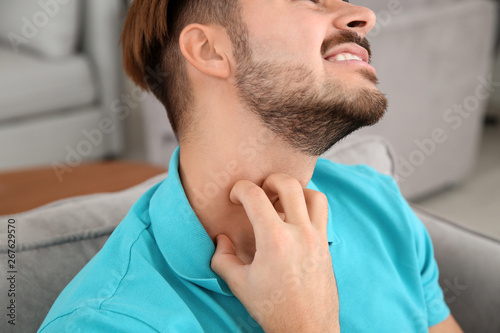 Young man scratching neck at home, closeup. Annoying itch