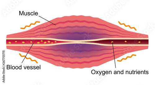 Blood flow worse  . Flat illustration of muscle and vessel. 