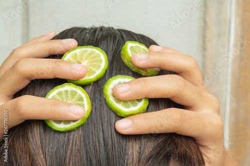 Bergamot and treatment of hair and scalp that is itching and falling