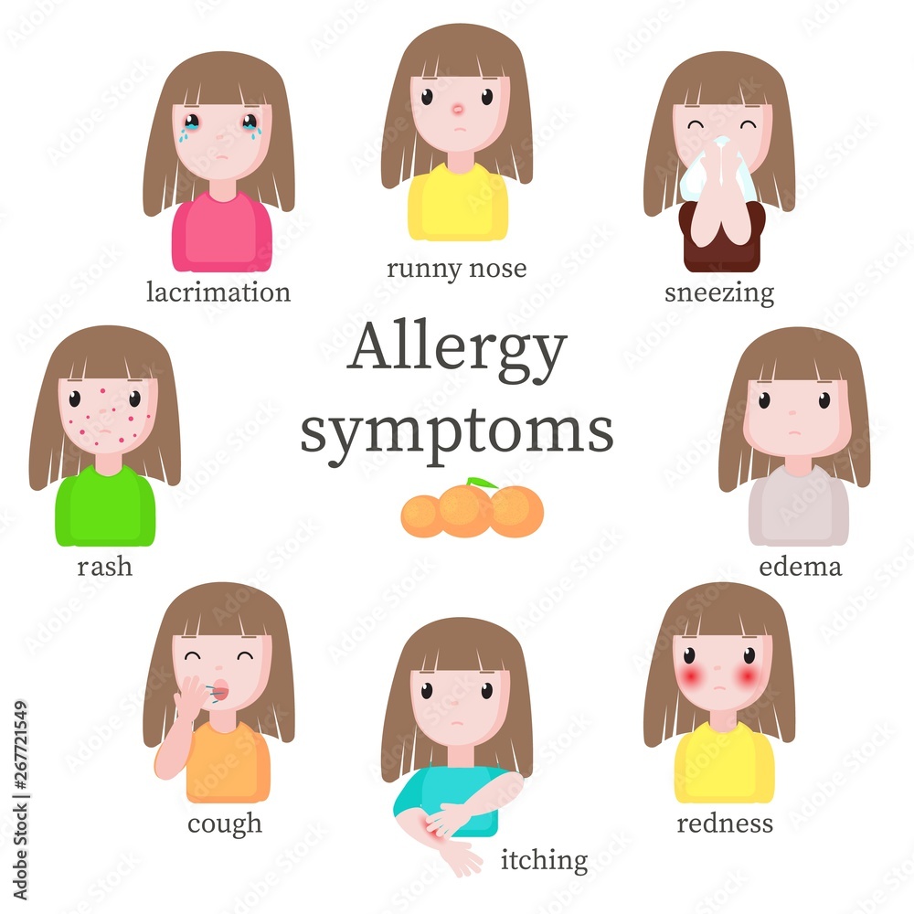 Allergy symptoms, vector flat style design isolated illustration Allergy symptoms, vector flat style design isolated illustration