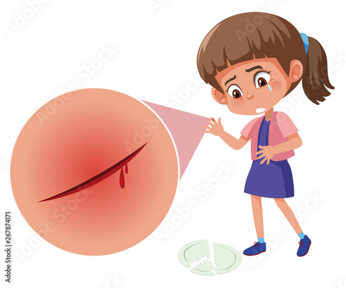 A girl cut her finger