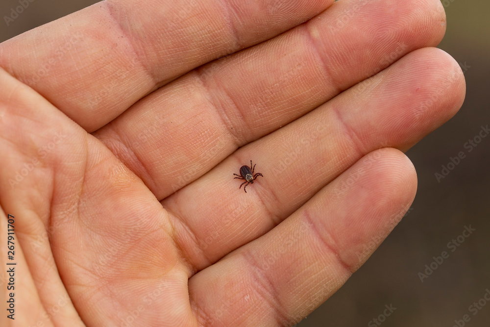 Ixodes ricinus, the castor bean tick, is a chiefly European species of hard-bodied tick. Carrier Lyme disease and tick-borne encephalitis on the human arm. Ixodes ricinus, the castor bean tick, is a chiefly European species of hard-bodied tick. Carrier Lyme disease and tick-borne encephalitis on the human arm.