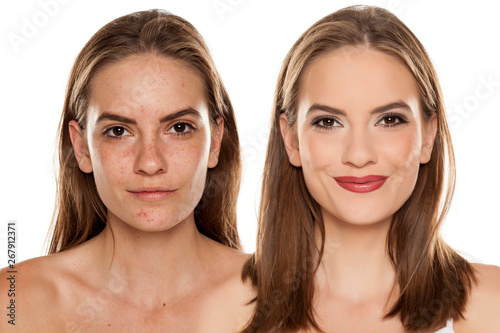 Comparison portrait of young beautiful woman before and after skin treatment and makeup on white backgeound photo