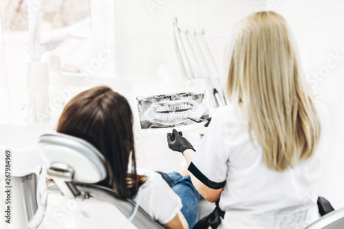 Dentist showing x-ray for the patient and explaining plan of treatment.